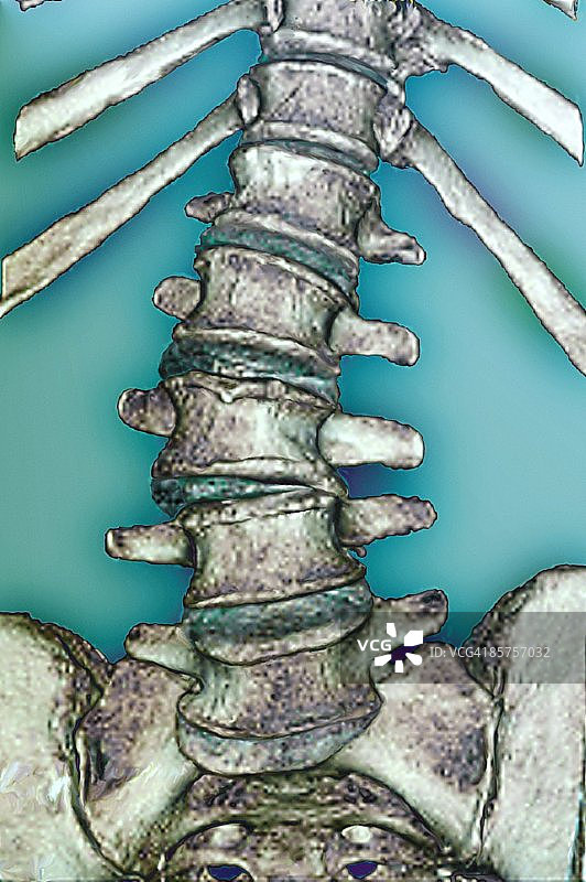 脊柱扫描图片素材