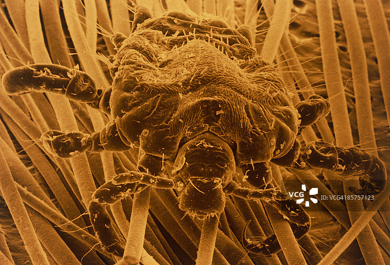 阴虱的彩色扫描电子显微照片图片素材