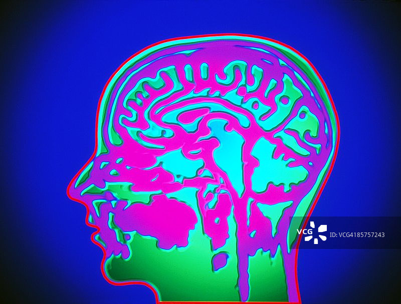 脑部核磁共振扫描特写图片素材