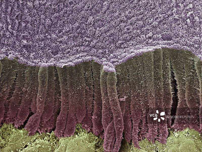 彩色扫描电子显微照片图片素材