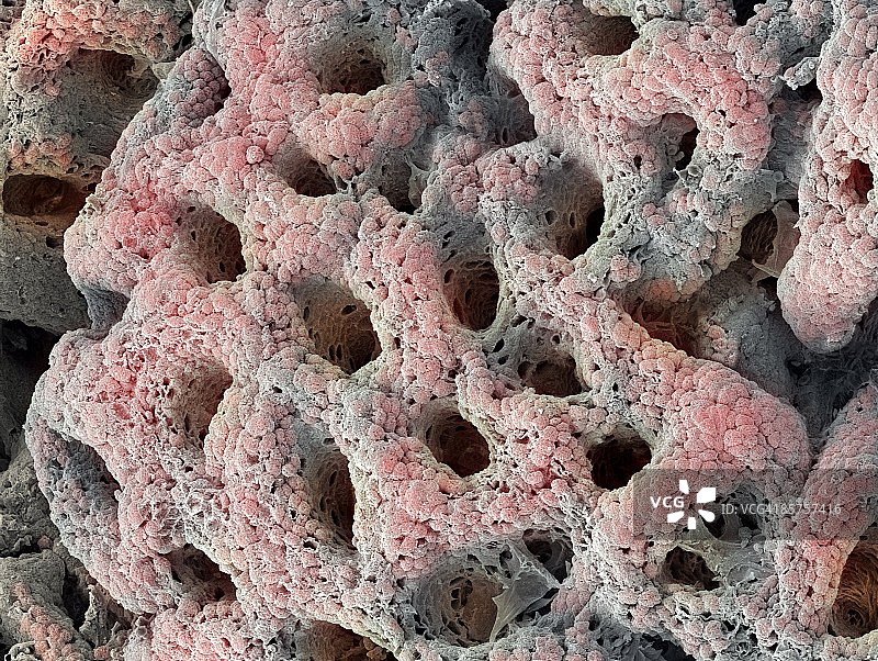 胃内壁图片素材