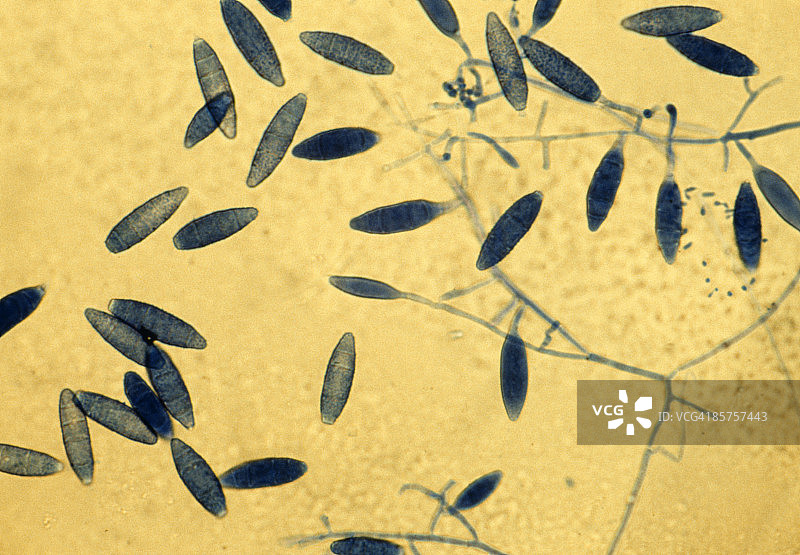 真菌的光学显微照片图片素材