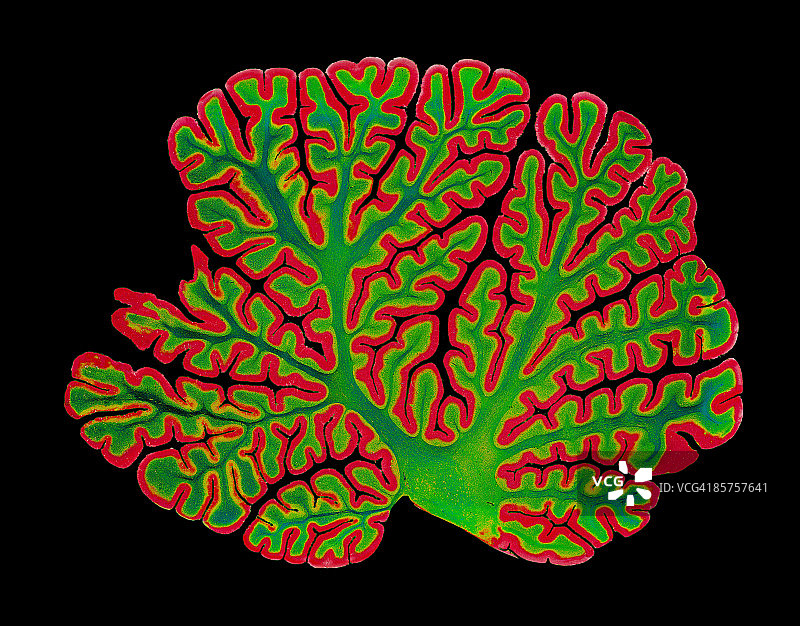 脑组织的光学显微照片图片素材