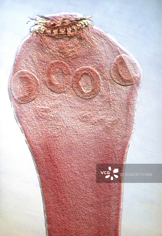 寄生绦虫的显微照片图片素材