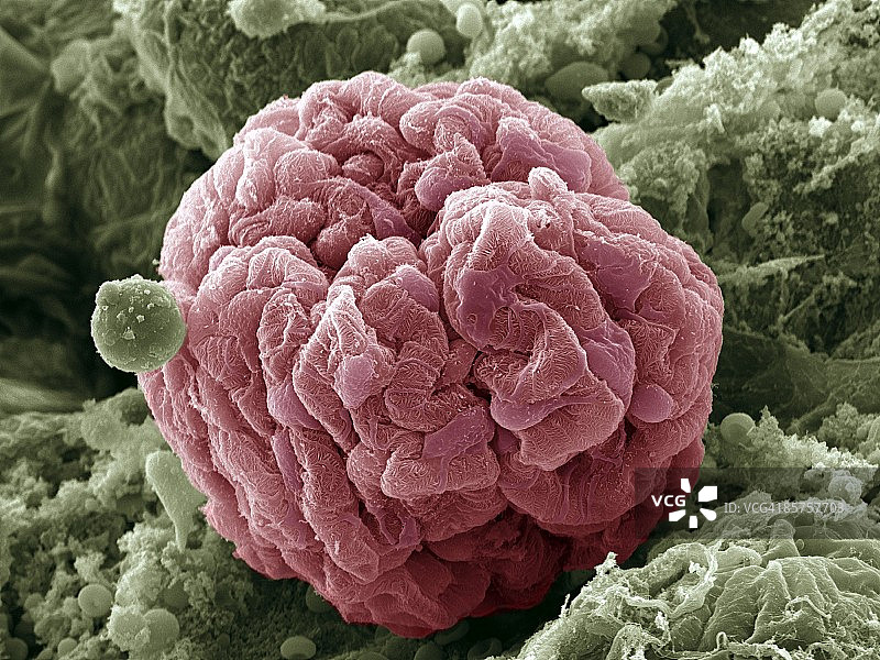 彩色肾小球扫描电子显微镜图像图片素材