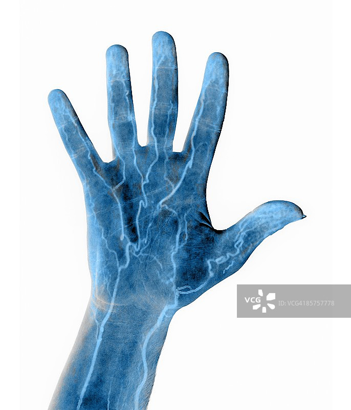 手部供血图片素材