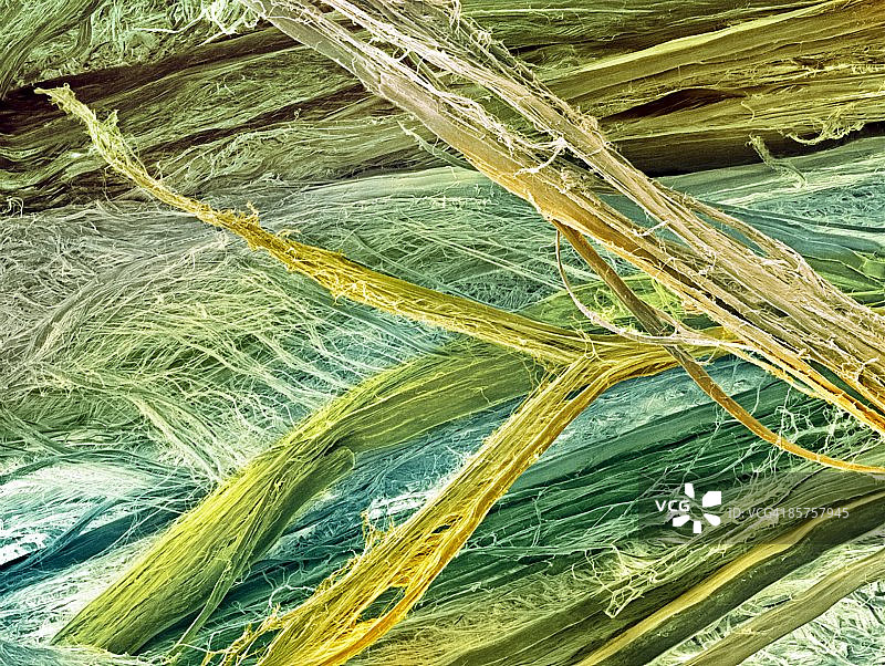 肌腱的扫描电子显微照片 (SEM)图片素材