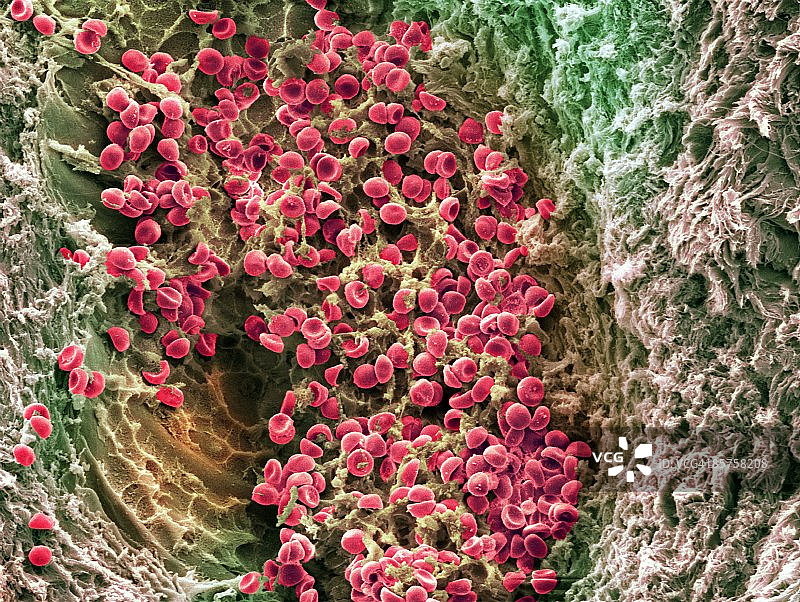 红细胞扫描电子显微镜照片图片素材