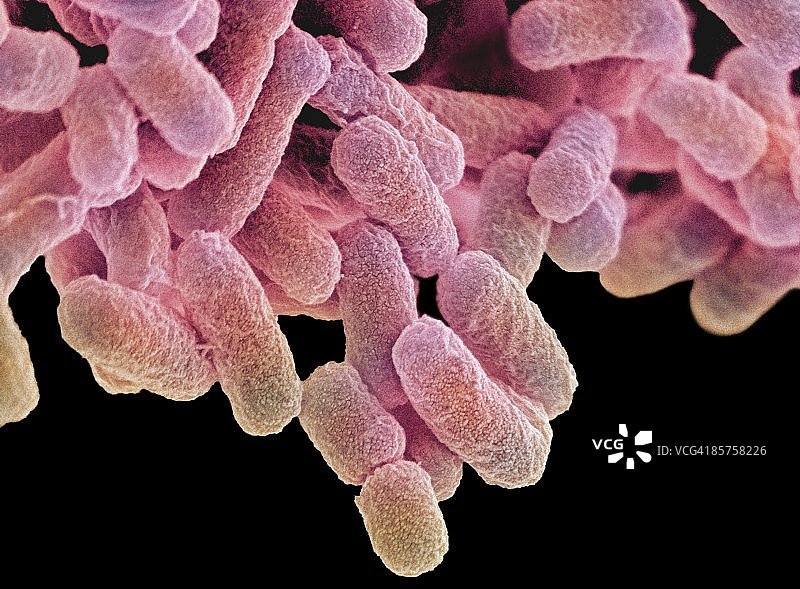 彩色扫描电子显微照片图片素材