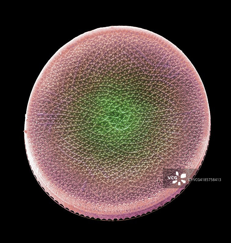 彩色扫描电子显微照片图片素材