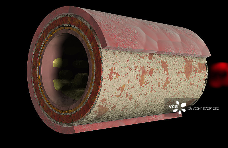 动脉壁图片素材