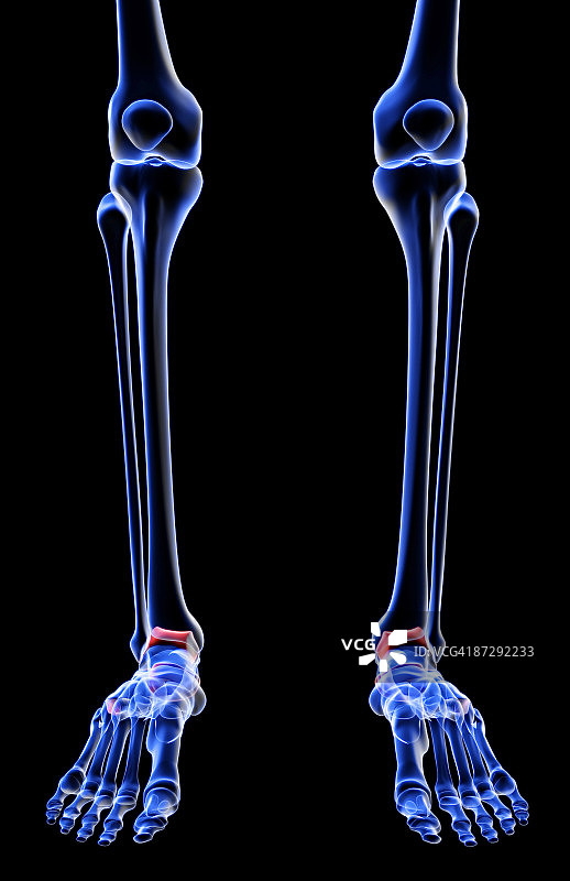 腿部骨骼图片素材
