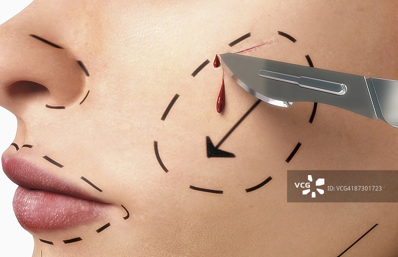 除皱术图片素材