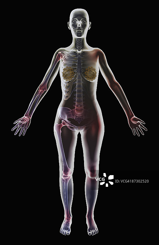 脊椎炎图片素材