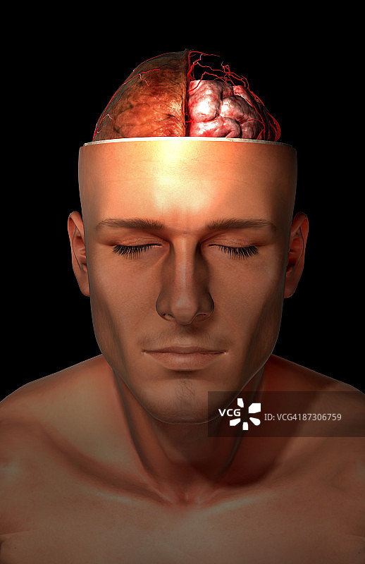 大脑动脉图片素材