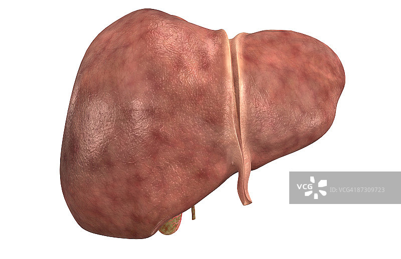 肝脏图片素材
