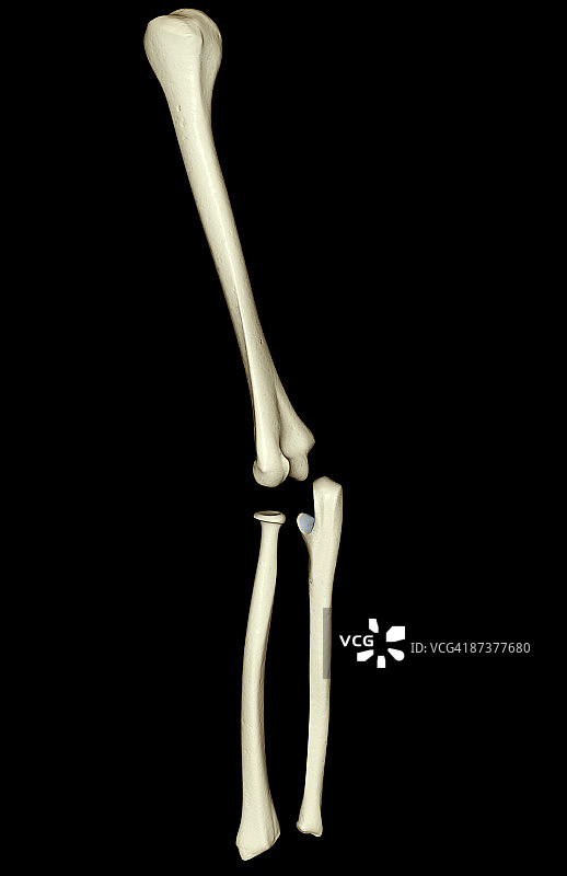 上肢骨骼图片素材