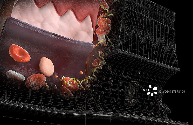 血栓形成图片素材