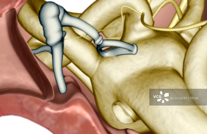 听小骨图片素材