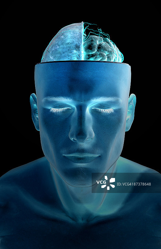 大脑动脉图片素材