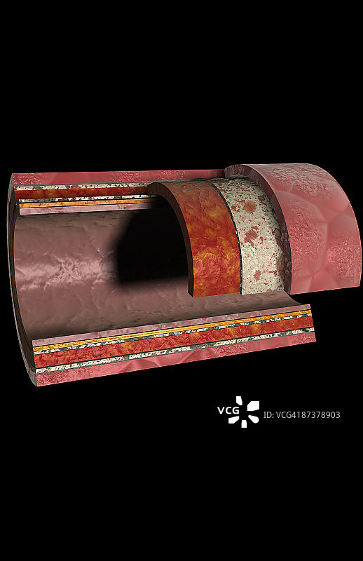 动脉壁图片素材