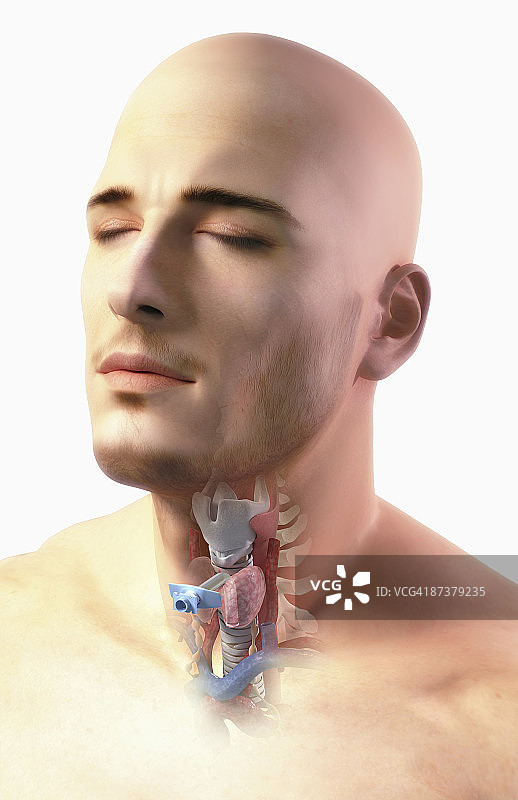 气管切开术图片素材