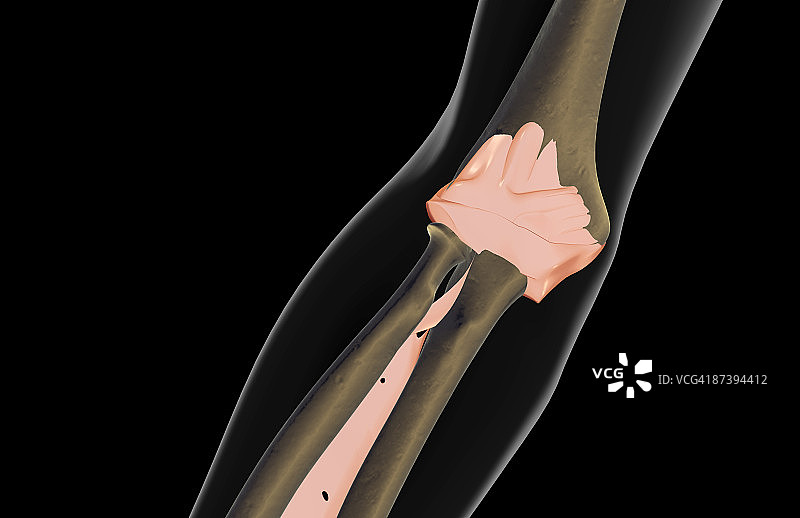 肘部的韧带图片素材