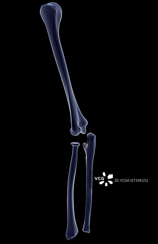 上肢骨骼图片素材