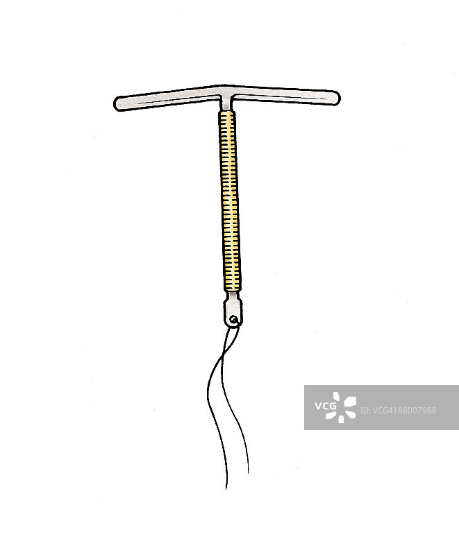 宫内节育器图片素材