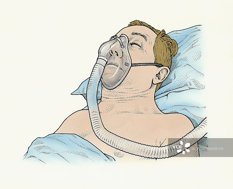 戴着面罩的睡眠呼吸暂停患者图片素材