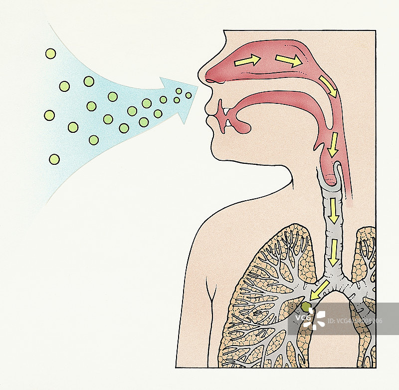 曲霉菌球对人肺部的影响图图片素材