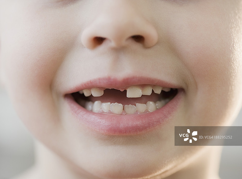 缺牙男孩的肖像图片素材