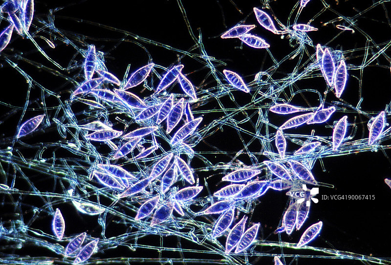 犬小孢子菌引起的头癣图片素材