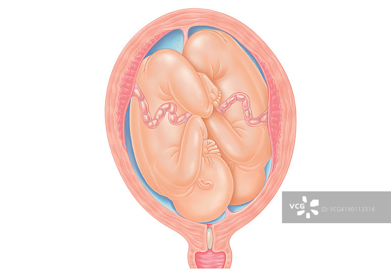 子宫内正常位置双胞胎的数字横截面图图片素材