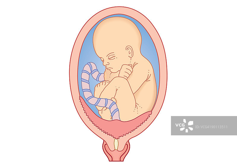 前置胎盘数字图解：胎盘完全覆盖宫颈，附着于子宫壁图片素材