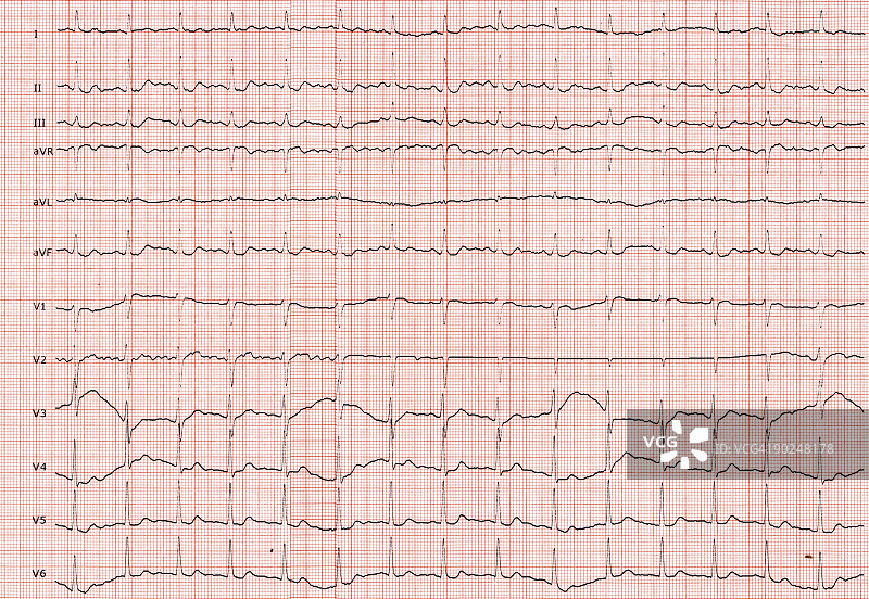 心电图仪图片素材