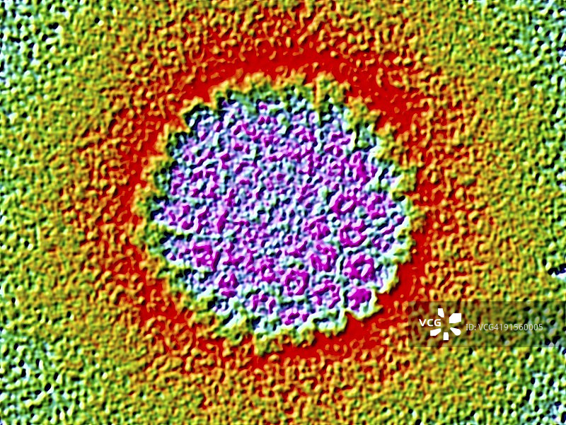 人乳头瘤病毒图片素材