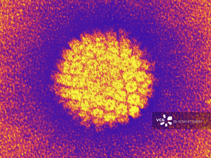 人乳头瘤病毒图片素材