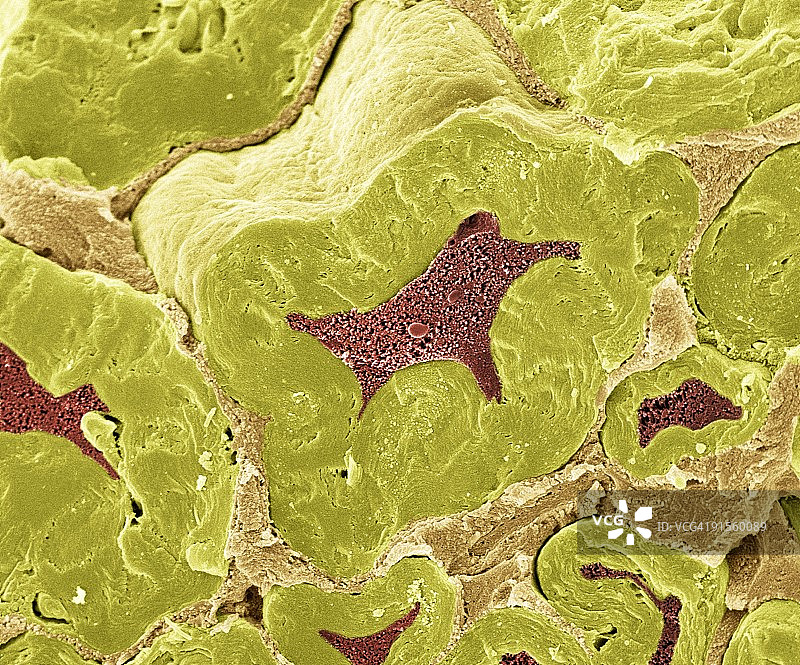 神经纤维扫描电镜显微照片图片素材