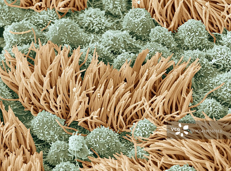 输卵管，扫描电镜图片素材