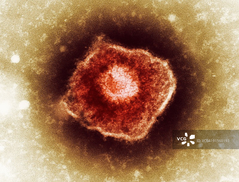 带状疱疹病毒颗粒（彩色透射电子显微照片）图片素材