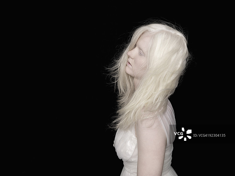 白化病女人图片素材