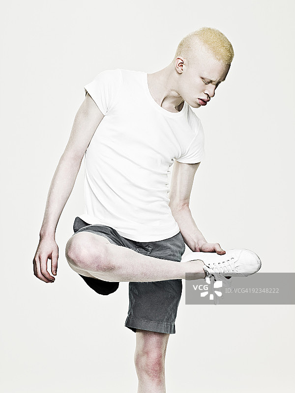 看着鞋底的白化病男人图片素材