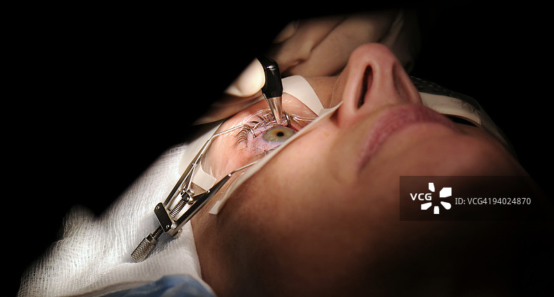 激光眼科手术图片素材