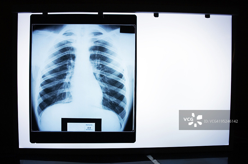 观片灯图片素材