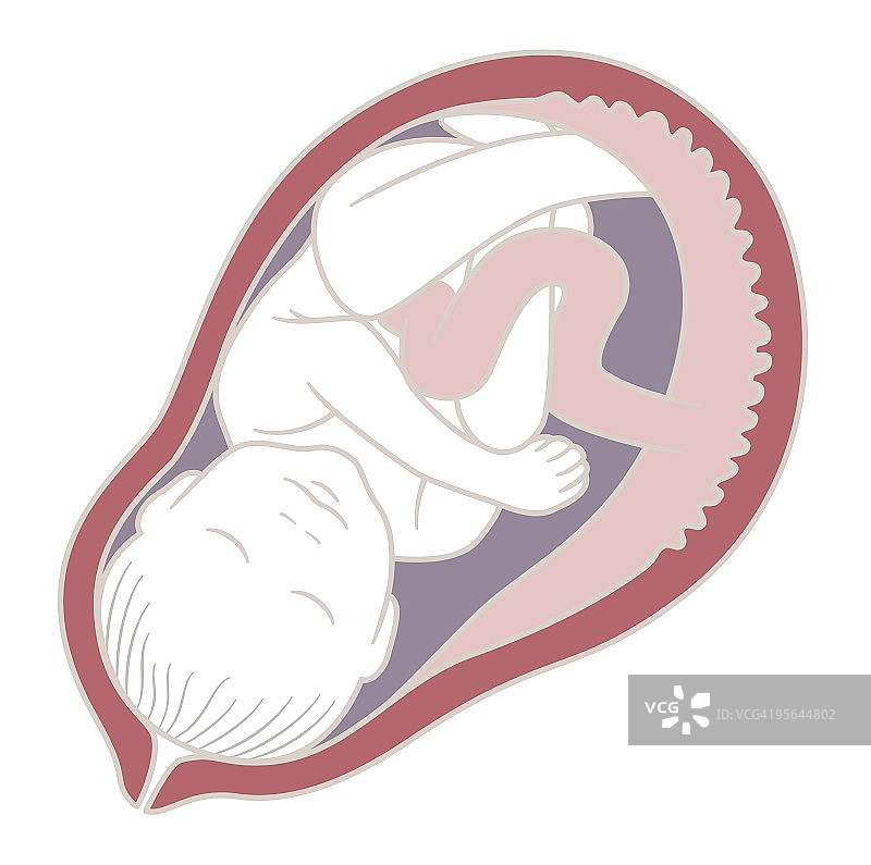 40周人类胎儿在子宫内，头部位于产道入口的数字图图片素材
