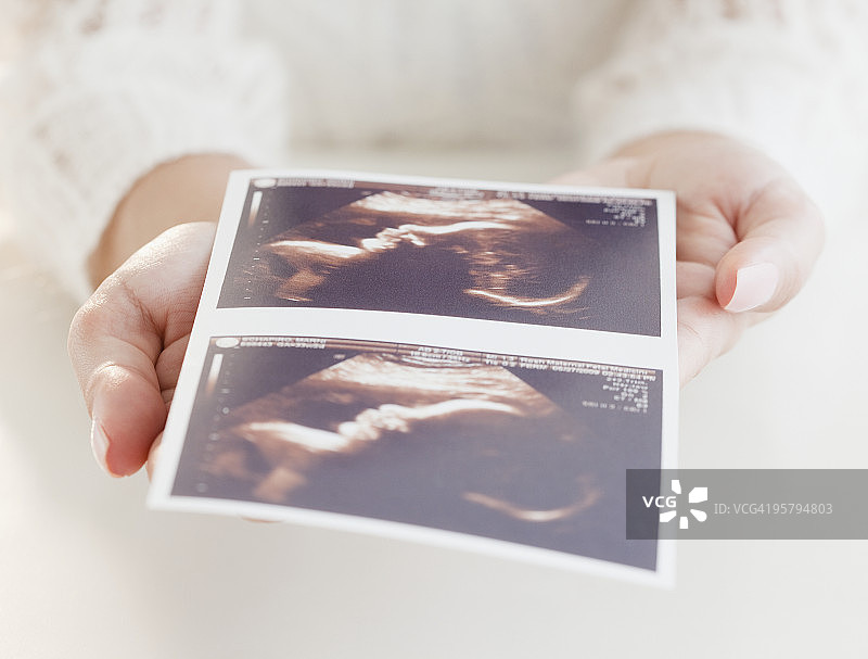 女人拿着超声波图图片素材