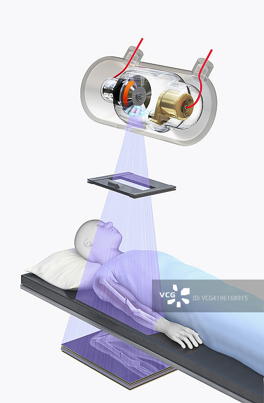 X光机为病人检查插画图片素材