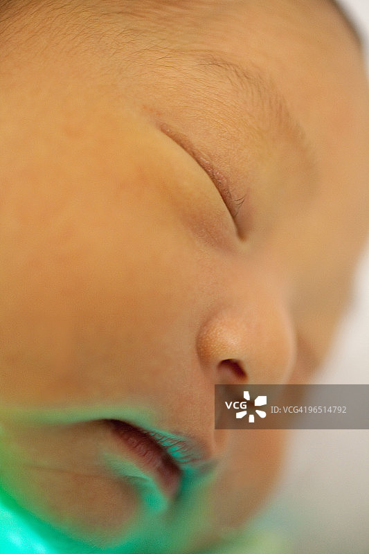 患有黄疸的新生儿，紫外线光疗图片素材