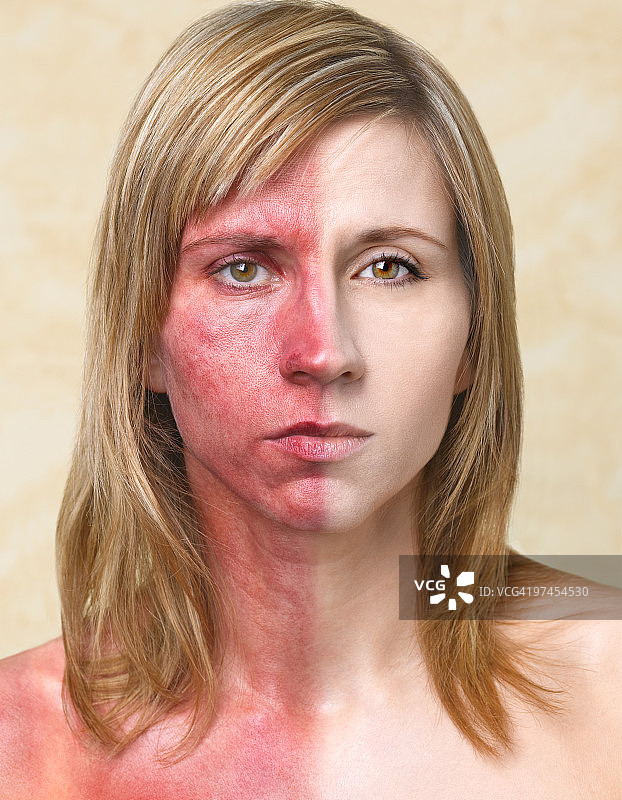 晒黑前后皮肤损伤对比的女人图片素材